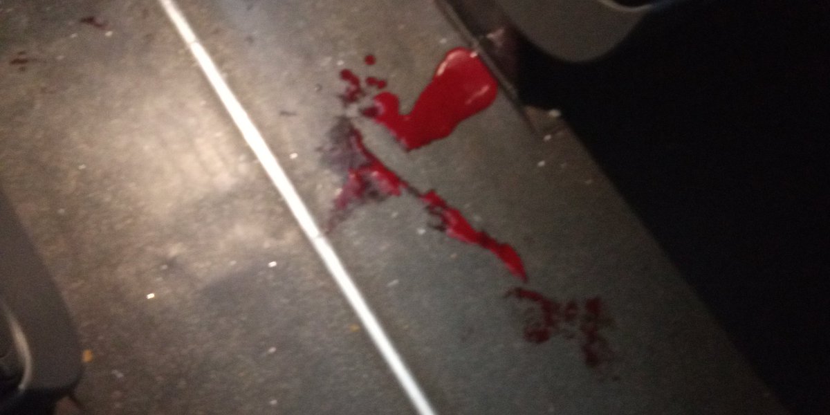 Caravan of MPs that moves to the city of San Cristóbal Táchira, was attacked by two blunt objects at the height of Guanare, Portuguesa. One of drivers seriously wounded