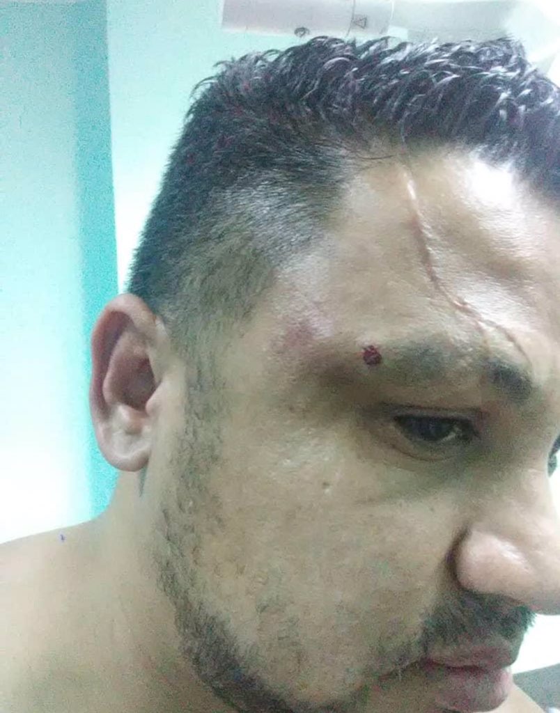 Tense situation in Cojedes Hospital taken by Colectivos. Colectivos injure Nora Galíndez, Medicine resident and Head of the orthopedic service of the Hospital Egor Nucette Dr. Próspero González was beaten by Colectivos in the Hospital