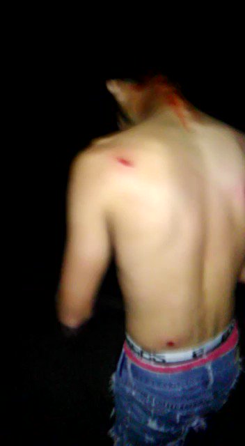 Many wounded in crackdown in Cumana last night